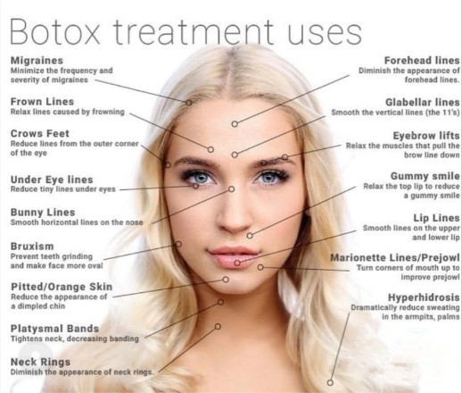 ISO Wrinkle Removal Allergan 100 Units For Face Lift Injection