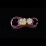 Comfortable Partial Valplast Flexible Dentures Nylon Material