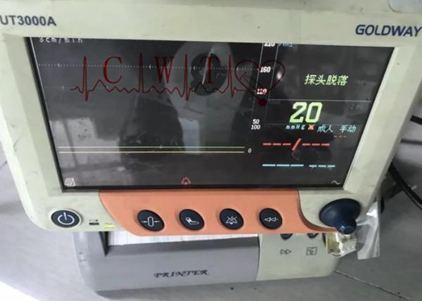 85dB Hospital Vital Signs Monitor , Used PHiliph 3000A Real Time Health