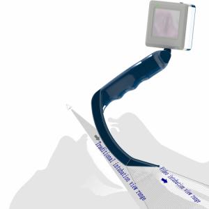 China Curved Blade Laryngoscope Macintosh And Miller Laryngoscope Types factory