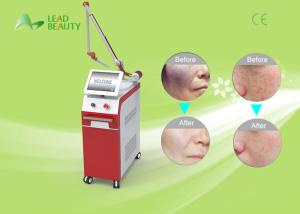 China professional Q-Switch ND YAG laser tattoo removal machine with high power factory