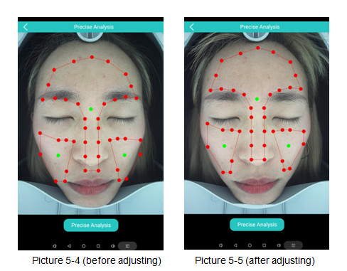 High Definition Facial Analysis 3D Digital Observ Machine with RGB UV