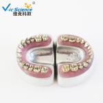 Advance PVC Plastic Child Caries Teeth Model Dental Life Size Eco - Friendly