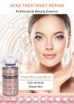 Best Facial Acne Treatment Product Remove Acne Smooth Skin And Shrink Pores