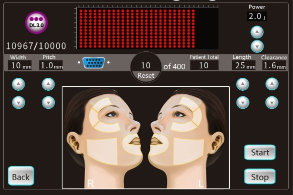 4D Hifu Non Surgical Face Lift Equipment