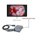 TUYOU Integrated Portable Full Hd Medical Imaging Endoscope Camera Android For