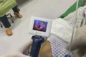 China Portable Video Laryngoscope Flexible Fiberoptic Diagnostic Mac 4 Blade Intubation factory