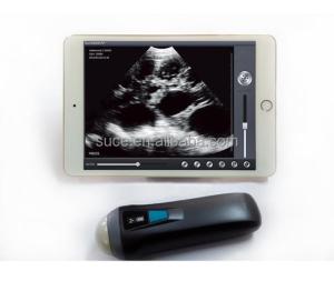 China Laptop color Doppler ultrasound system Uprobe-1 factory
