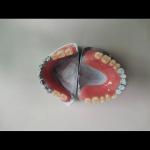 Removable Lower Upper Partial Acrylic Denture For Missing Teeth