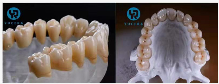 Hot Sale 4D Dental Ceramic Pre-Shaded Multilayer Zirconia Block Cad Cam Dental Lab for Half Mouth