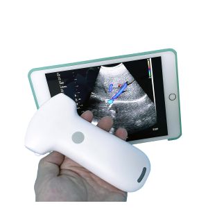 Affordable Ultrasound Equipment Wireless Convex Array Medical Probe MSLPU94