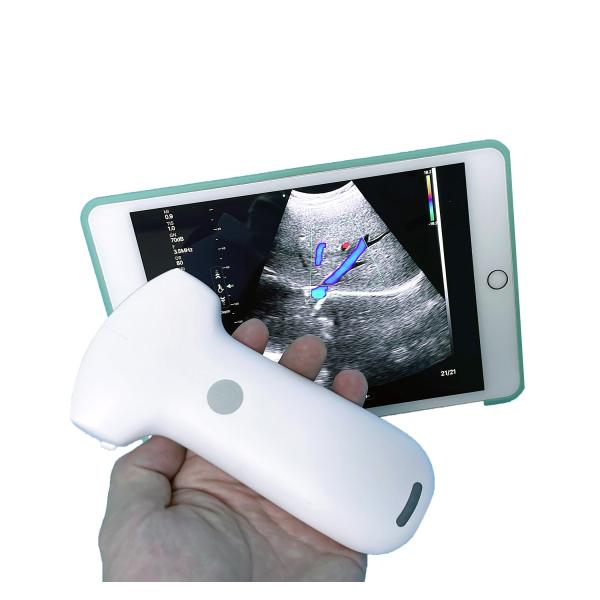 China Affordable Ultrasound Equipment Wireless Convex Array Medical Probe MSLPU94 factory