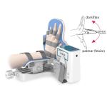 Fracture postoperative rehabilitation hemiplegia dystonia electric manual dual