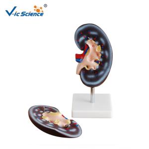 China Medical Science Human Body Anatomy Model Human Kidney Model 20x10x7CM factory