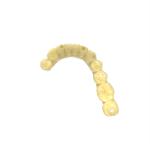 Precision Crafted Dental Resin 405nm Dental Resin For 3d Printing