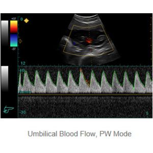 Ipad Ultrasonic Diagnostic Device Portable Ultrasound Scanner with 500G Image