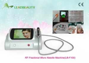 China 2017 beauty stretch mark removal rf fractional micro needle facial machine factory