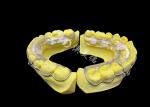 Beagle Retainer for Effective Smile Retention and Long-Lasting Alignment