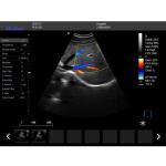 Hospital Diagnostic Machine Full Digital 4D Color Doppler Ultrasound Scanner