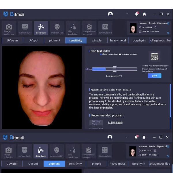 User Friendly Usb Computer Face Skin Analyzer