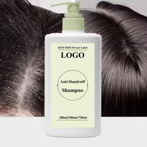 China Oil Control Anti Dandruff Anti Itchin Shampoo Deep Cleansing Hair Shampoo factory