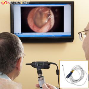 China 5mm 1080p 60fps Otoscope Ear Camera Endoscope Endoscopy Camera Module factory