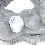 Dental Crowns Permament Resin High Precision for Superior Results in Crown
