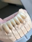 57% High Translucent 1050 Mpa Dental Zirconia Discs 20mm 22mm 25mm