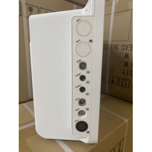 Portable Patient Monitor With Parameters Of ETCO2 ECG NIBP SPO2 RESP TEMP PR