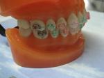 Orthodontic Teeth Development Model CE Certified ALS Dental Teaching Models with