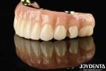 Transform Your Dental Restoration With Ti-Bar Zirconia Hybrid Bridge Durable And