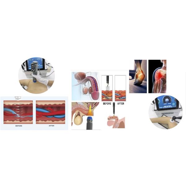 3 In 1 Smart Tecar Pain Relief Physical Therapy Ems Shockwave Machine For ED Treatment