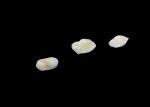 Biocompatible Ceramic Inlays and Onlays Designed for Comfort Durability and