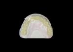 High Translucency Zirconia Dental Bridge Strong and Natural Looking for Seamless