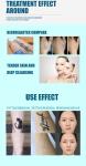 1320w Q Switch Nd Yag Laser Machine Commercial Tattoo Removal Beauty Machine