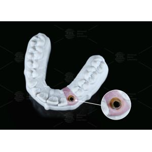 Internal Hex Custom Titanium Abutment Screw Cement Retained Varying Shape