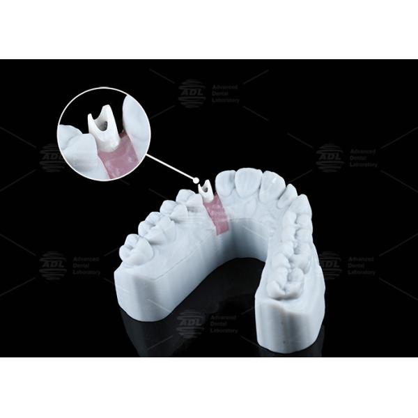 China White Custom Zirconia Abutment Natural Looking Aesthetics And Optimal Functionality factory