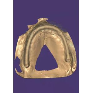 3D model Zirconia crown