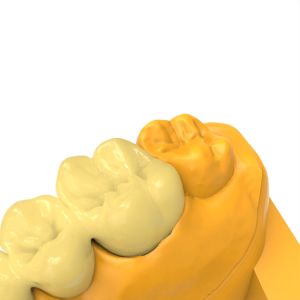 Odorless Permanent Crown Bridge Resin