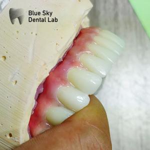 China Nature Surface Universal Compatible Multiple Choices Implant operation cases for Steam Sterilization factory