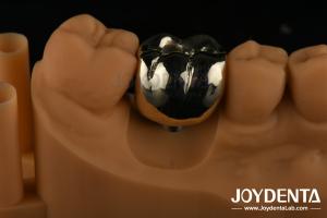 China Oral Rehabilitation Wax Casting FMC Full Metal Crown For Dental Clinical Repair factory