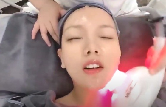 1300nm Shockwave Therapy Machine Nir Nearlight Milk Light Skin Rejuvenation Pulse Machine
