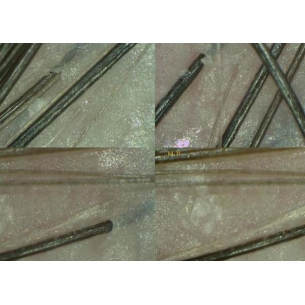 Digital Magnifier Handheld Video Dermatoscope Skin Analyzer with Data Report of Oil Moisture Pigment Flexible