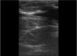B / W Palm Ultrasound Scanner Animal Ultrasound Scanner Using for Checking Mare