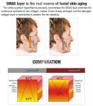 CE Certified Radio Frequency Skin Tightening Machine , Slimming Rf Beauty