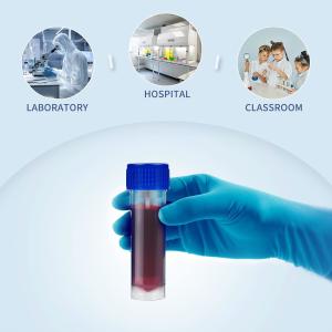 25-30ml Stool Specimen Cup Stool Container With Spoon Lid Specimen Container,