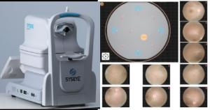China Professional Non Mydriatic Fundus Camera For Accurate Imaging factory