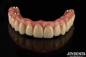 China Custom Titanium Malong Dental Hybrid Bridge Corrosion Resistance Adjustable factory