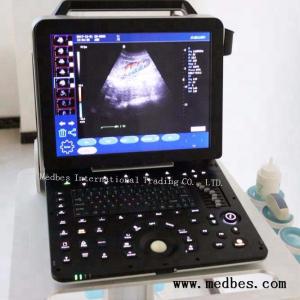 China 4D Portable Echocardiography Machine 4D Echo Color Digital Portable Ultrasound Machine factory