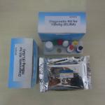 Medical Rapid Diagnostic 96pcs Elisa Test Kit Hbsag Hepatitis B Surface Antigen